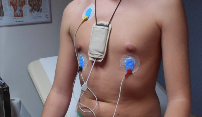 Holter Cardiaco Pressorio